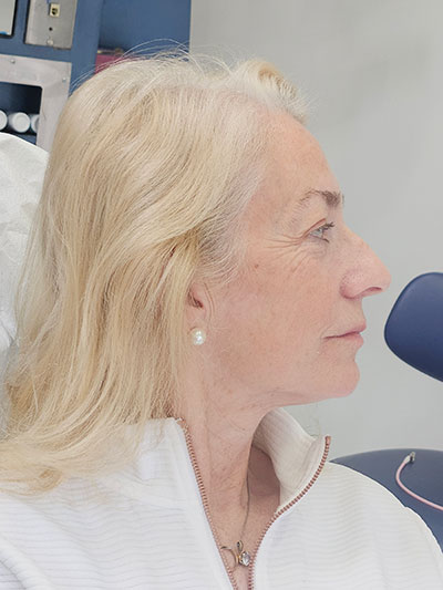 After FACE Dentistry