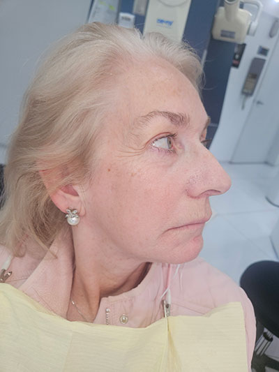 Before FACE Dentistry