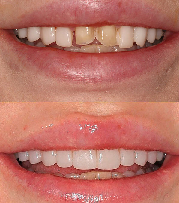 The Art of Facial Harmony: Part-2